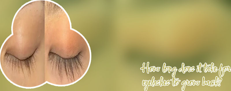 Best way to grow eyelashes